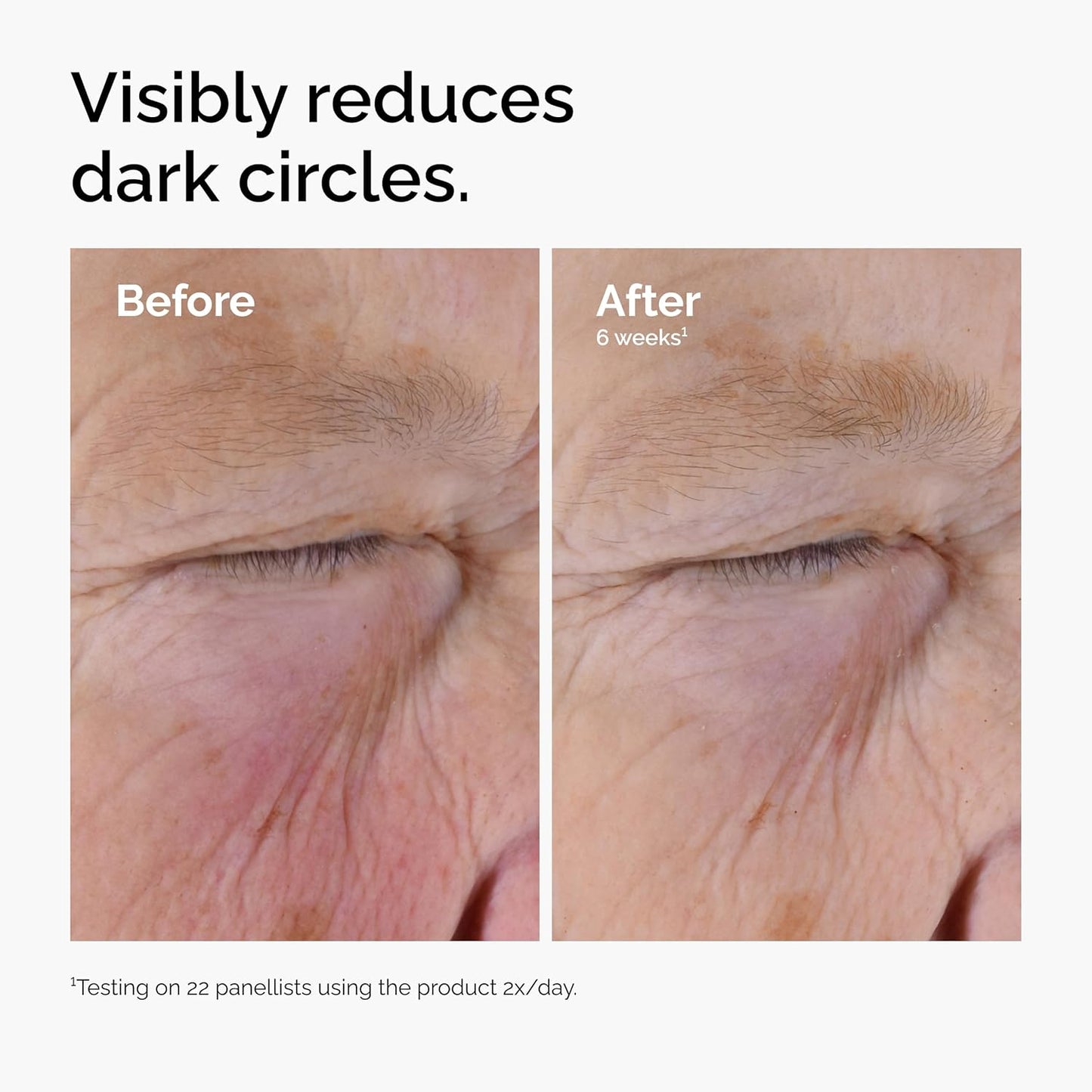 Ordinary Caffeine Solution 5% + EGCG – Depuffing Eye Serum for Dark Circles & Tired Eyes